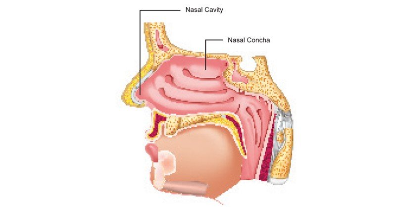 Nosal-Cavity
